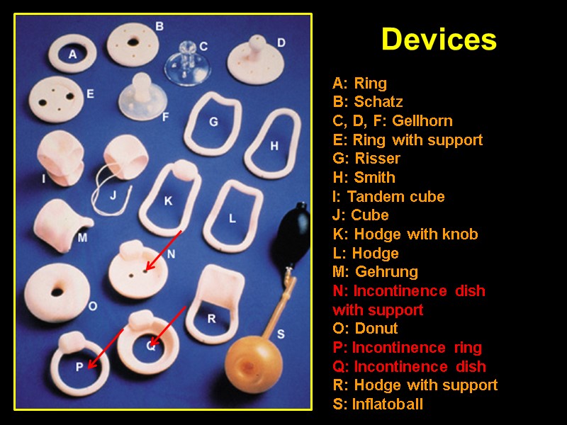 Devices A: Ring B: Schatz C, D, F: Gellhorn E: Ring with support G: